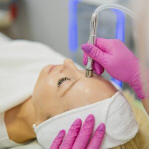 Microneedling